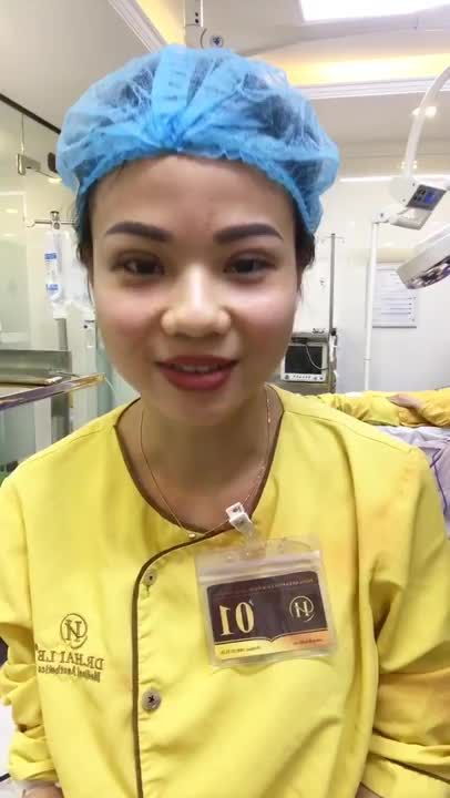 Đôi Mắt 2 Mí To Tròn Chỉ Sau 30 Phút Cắt Mí Tại Dr Hải Lê