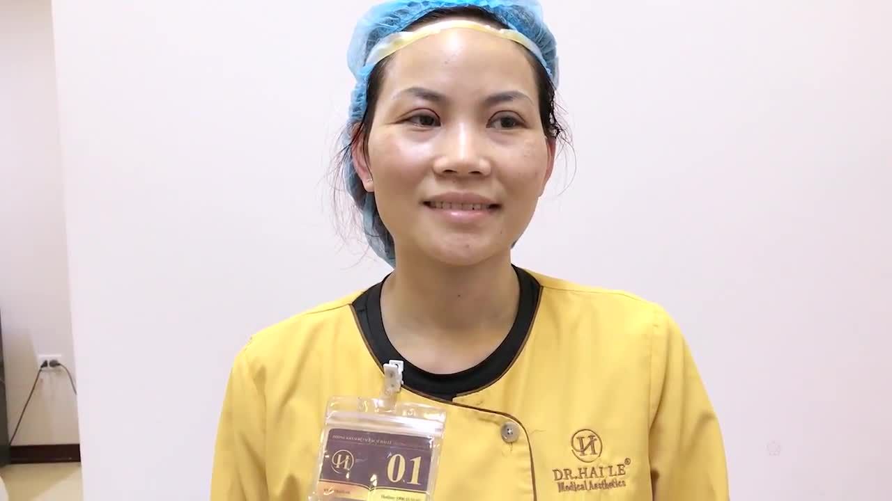 Kết Quả Cắt Mí Mắt Sau 30 Phút Tại Dr Hải Lê - Ca 83