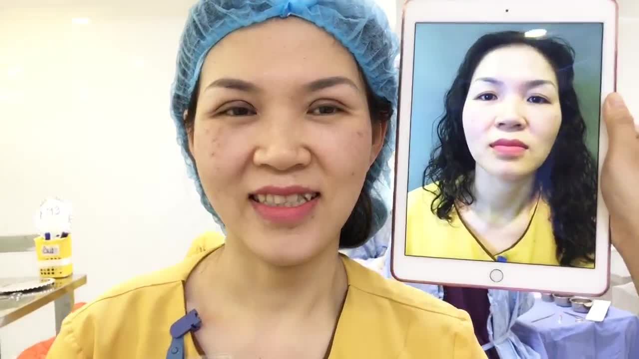 Mắt 2 Mí Đẹp Hoàn Hảo Sau Cắt Mí Tại Dr Hải Lê - Ca 89