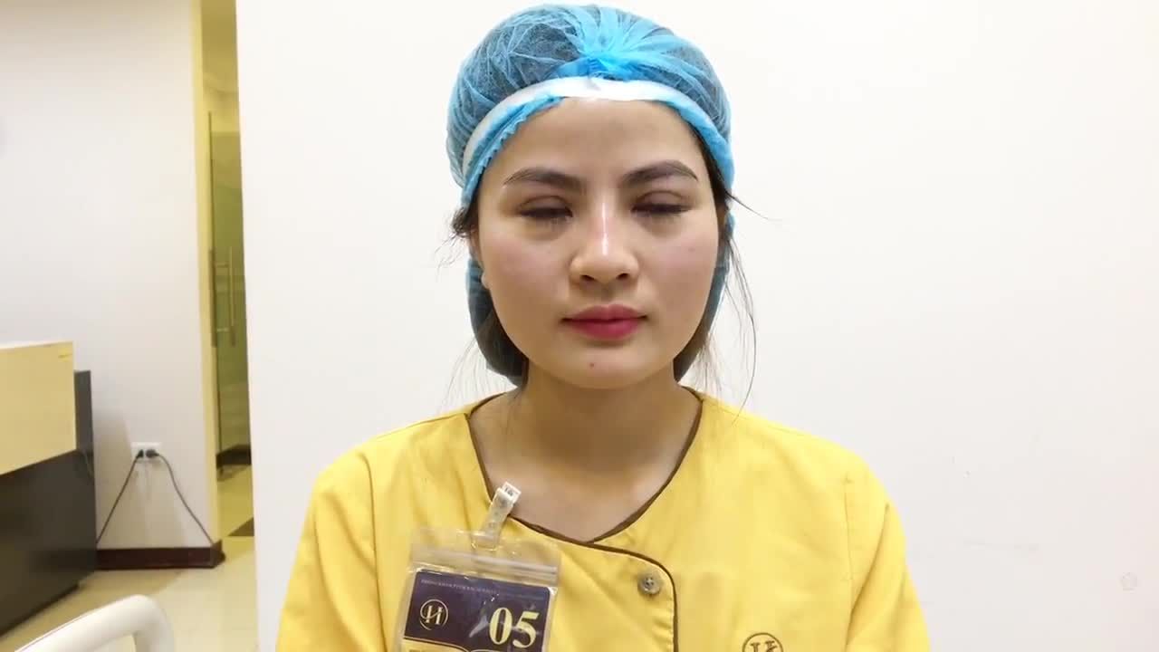 Mắt Đẹp Hoàn Hảo Sau Cắt Mí Mắt Tại Dr Hải Lê - Ca 86