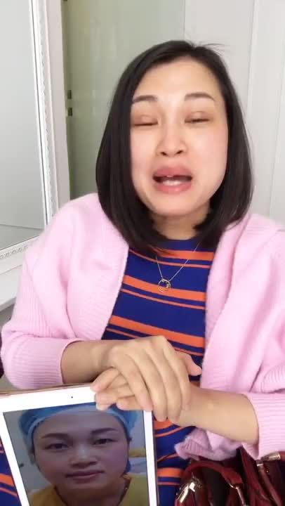 Mí Đẹp Sau 7 Ngày Cắt Mí Mắt Tại Dr Hải Lê