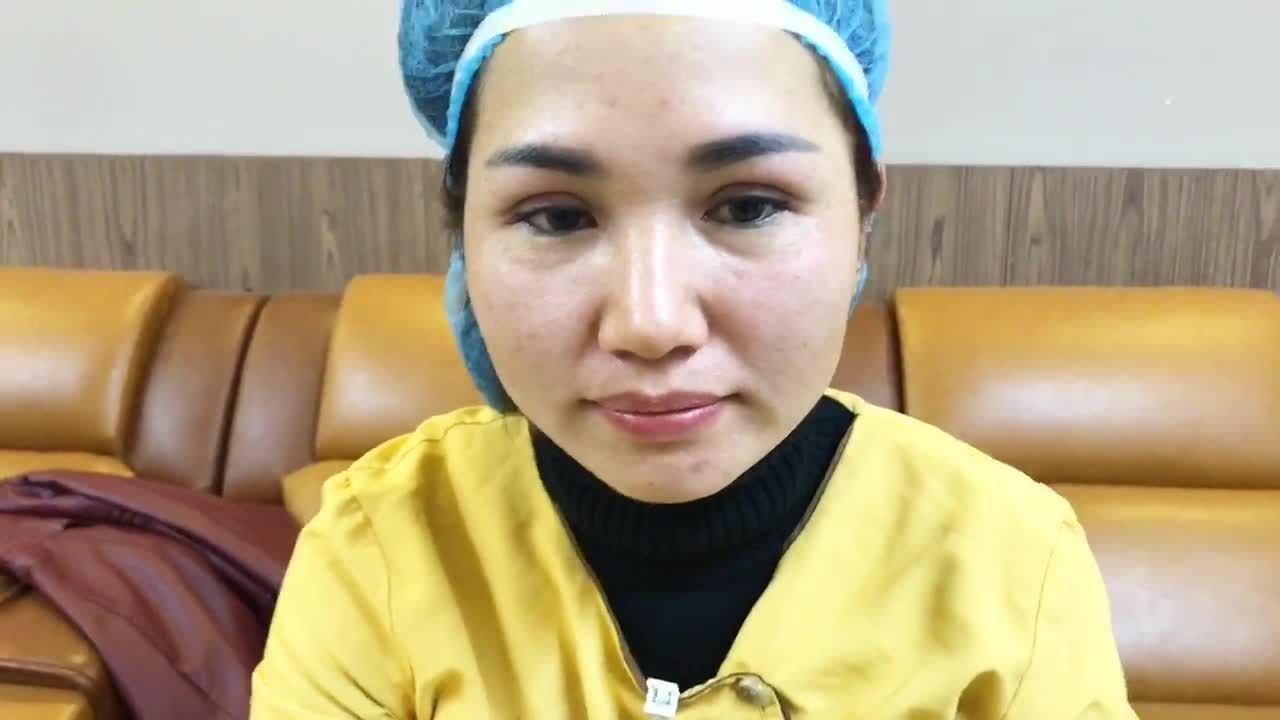 Tận Mắt Xem Nếp Mí Vừa Cắt Mí Xong Tại Dr Hải Lê - Ca 95