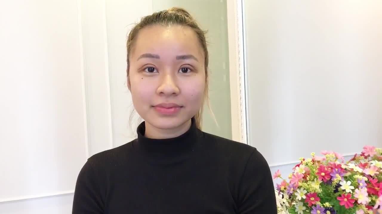 Tạo Mắt Cười Siêu Xinh Sau Khi Cắt Mí Mani Open Deep Tại Dr Hải Lê