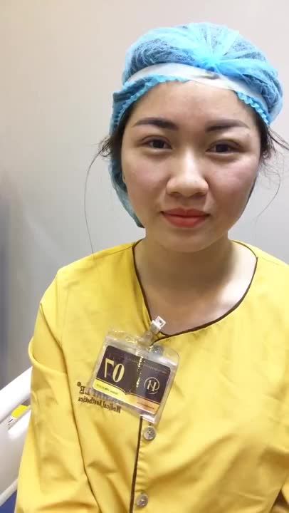 Biến Đổi Đôi Mắt Đẹp Hoàn Hảo Sau Cắt Mí Mắt Tại Dr Hải Lê - Ca 115