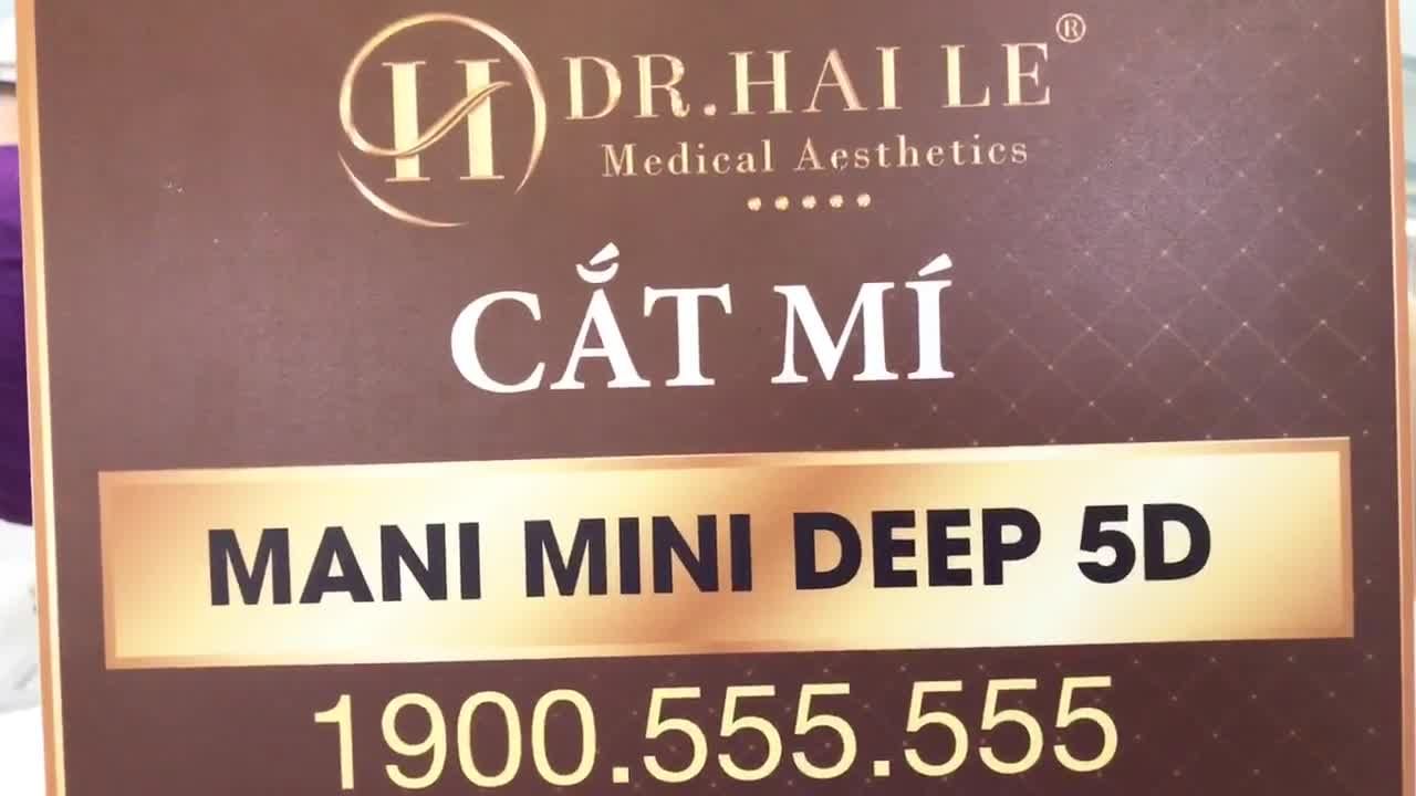 Cải thiện đôi mắt sụp mí nhờ cắt mí Mani Mini Deep 5D - Ca 278