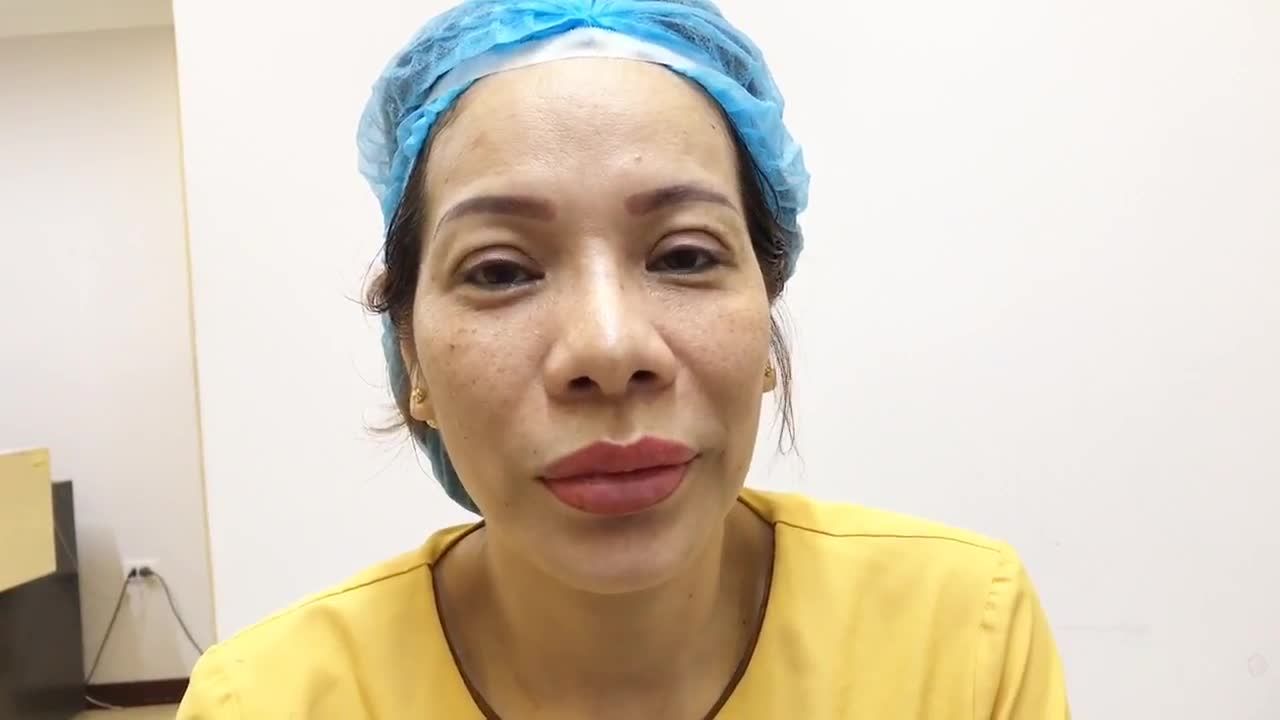 Cắt Mí Mắt Không Sưng Không Đau Chỉ Có Tại Dr Hải Lê