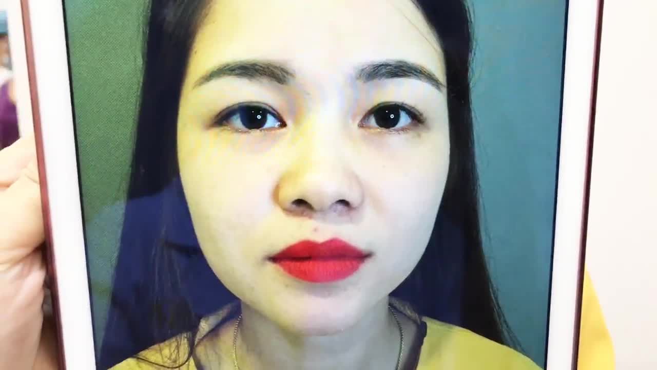 Cắt Mí Mắt Sụp Đẹp Hoàn Hảo Bằng Kỹ Thuật Mani Open Deep 5D - Ca 240