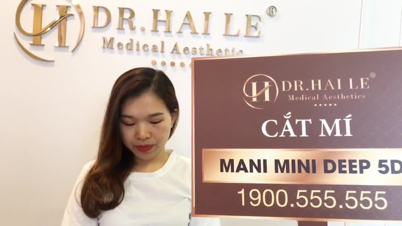Chiêm ngưỡng kết quả cắt mí Mani Mini Deep 5D sau 7 ngày
