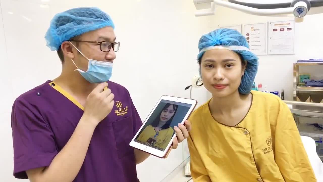 Chiêm Ngưỡng Nếp Mí Mới Vừa Cắt Mí Xong Tại Dr Hải Lê - Ca 142