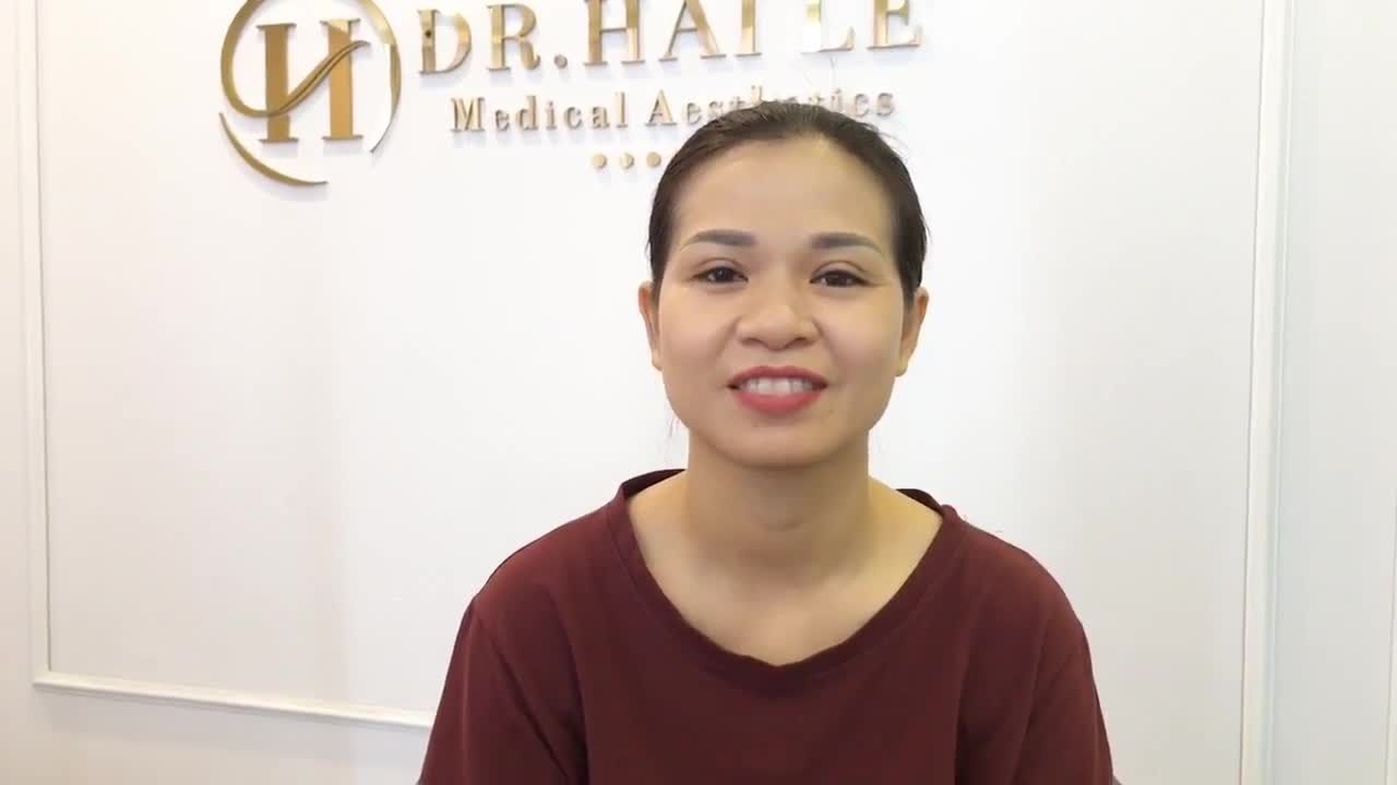 Chiêm Ngưỡng Nếp Mí Sau 1 Tháng Cắt Mí Tại Dr Hải Lê
