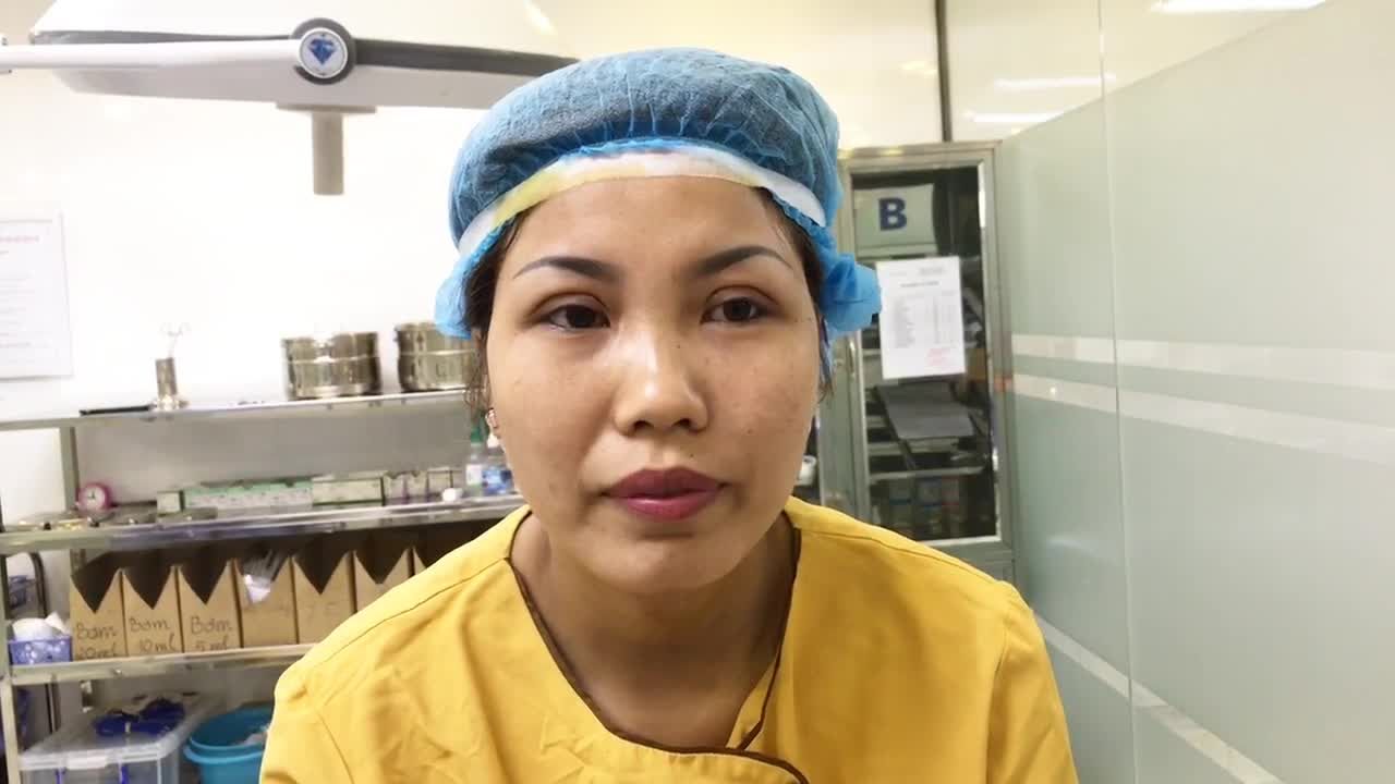 Đẹp Hơn Cả Tượng Tưởng Với Kết Quả Cắt Mí Mắt Tại Dr Hải Lê - Ca 216