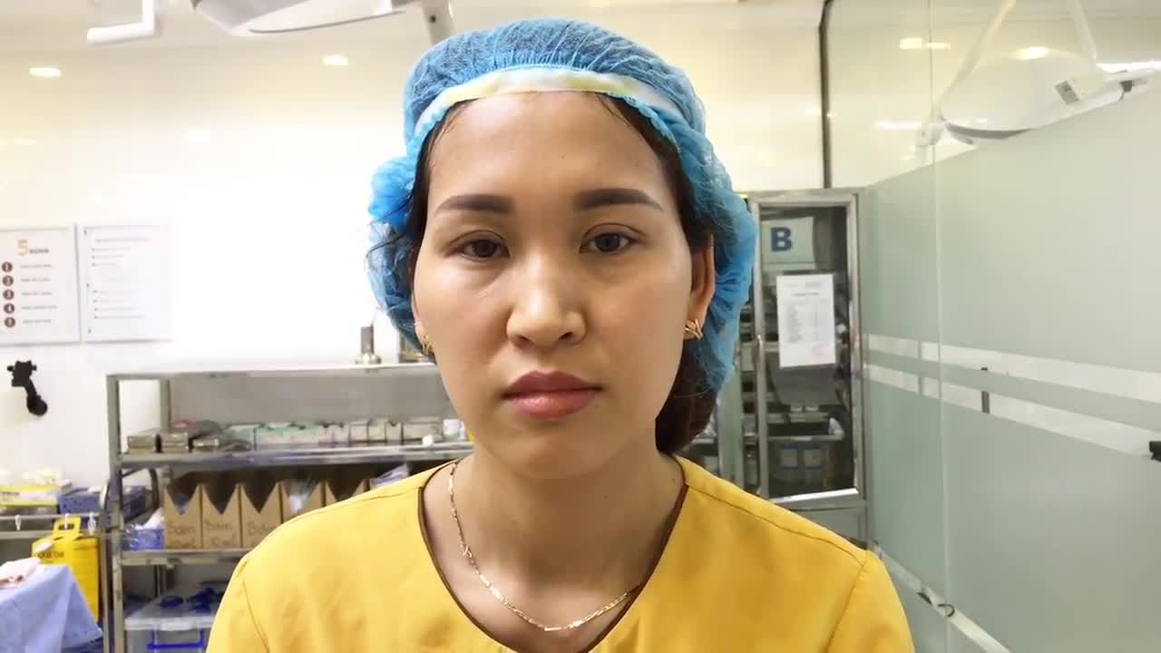 Đôi Mắt 1 Mí Thay Đổi 180 Độ Sau Khi Cắt Mí Mắt Tại Dr Hải Lê - Ca 198