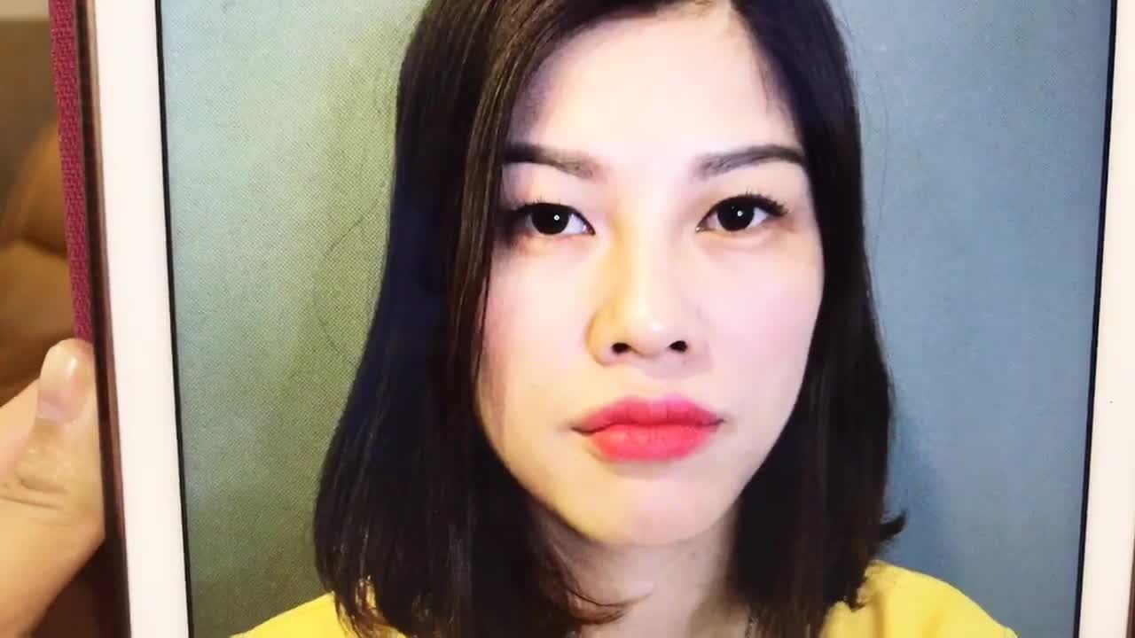 Đôi Mắt Cười Dễ Yêu Sau Khi Cắt Mí Mắt Mani Mini Deep 5D