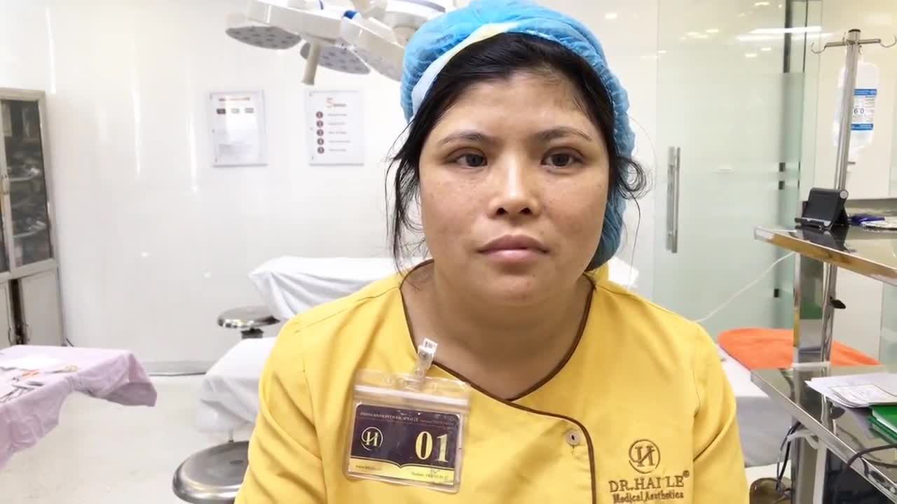 Kết Quả Cắt Mí Mắt Vừa Thực Hiện Xong Tại Dr Hải Lê - Ca 122