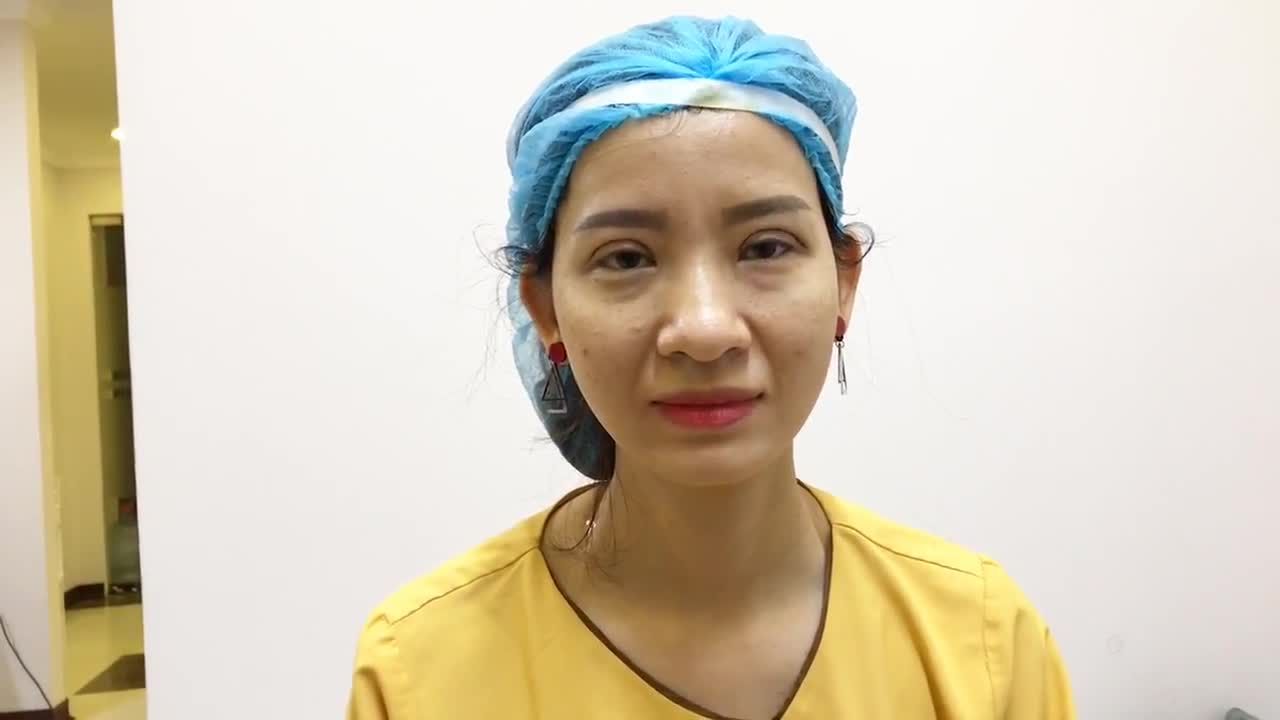 Kết Quả Cắt Mí Tự Nhiên Đến Nỗi Không Ai Nhận Ra Mắt Đã Thẩm Mỹ - Ca 151
