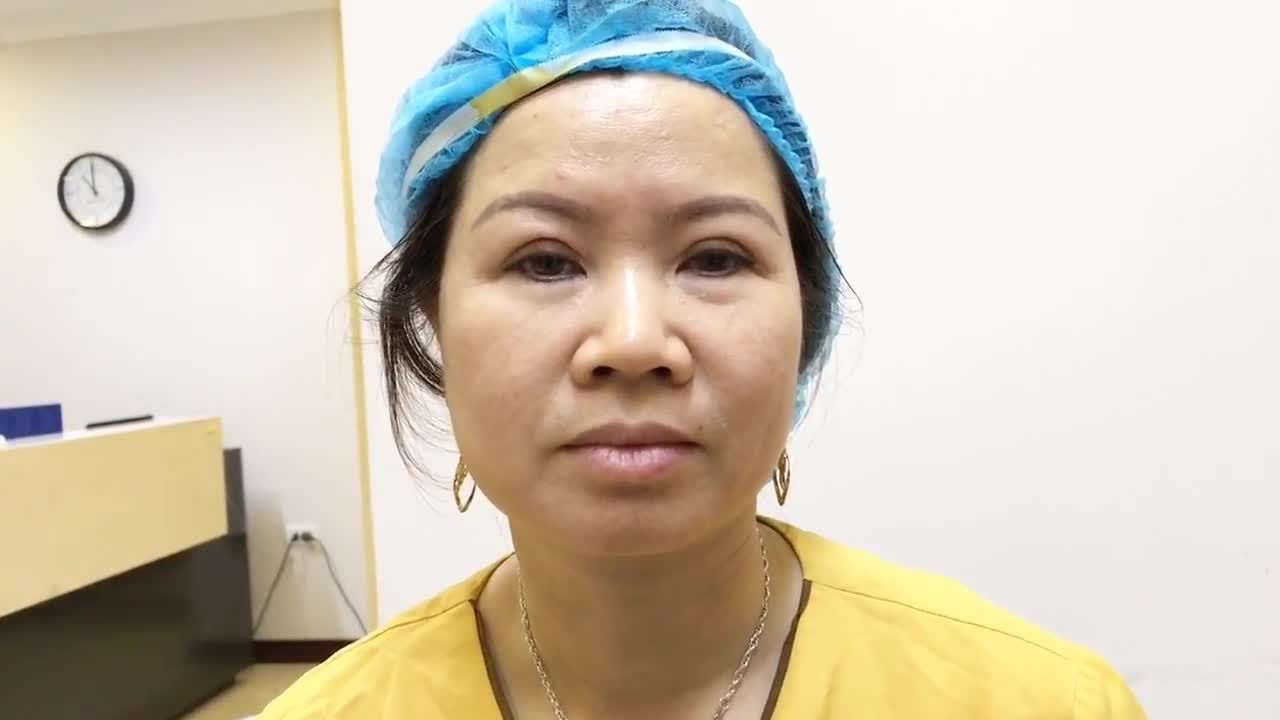 Kết Quả Vừa Thực Hiện Xong Cắt Mí Mắt Tại Dr Hải Lê - Ca 154