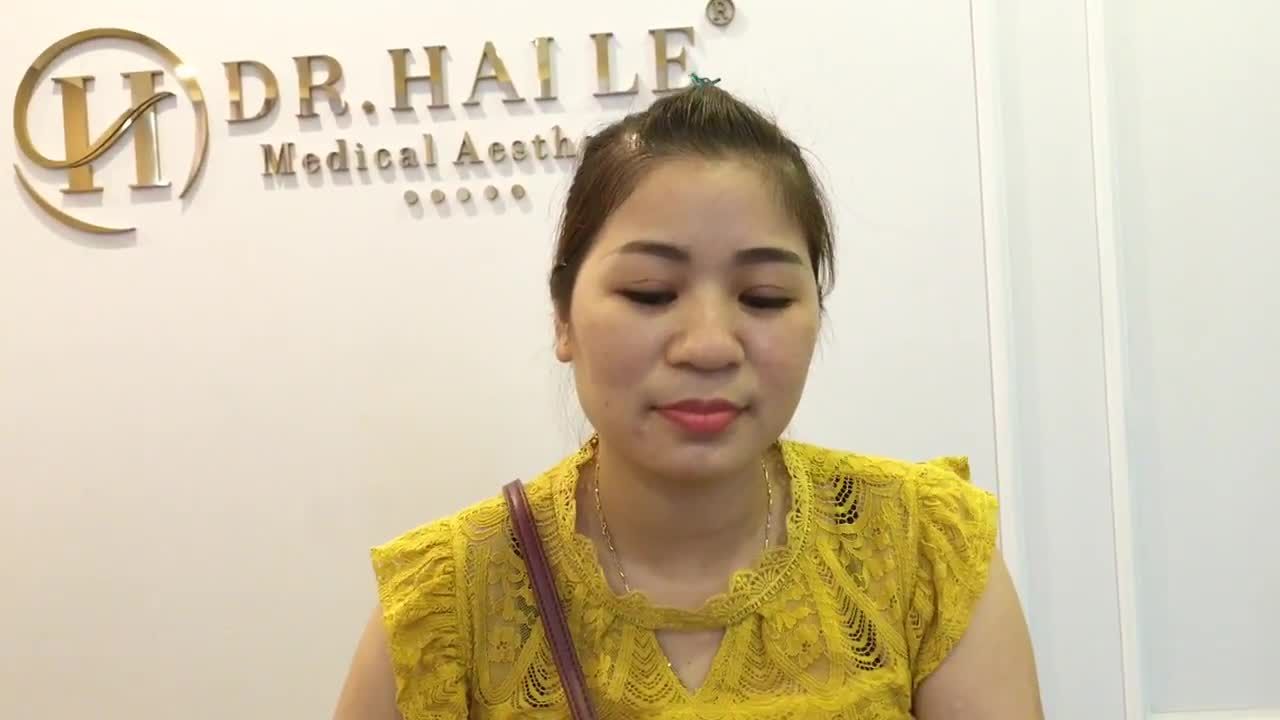 Khách Hàng Chia Sẻ Kết Quả Cắt Mí Mắt Sau 7 Ngày