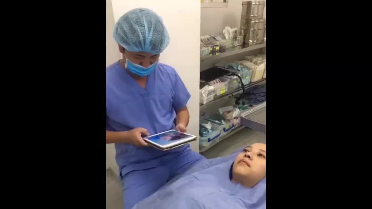 Khách hàng nâng mũi Sline 4D chỉnh xương - Thẩm mỹ Kangnam
