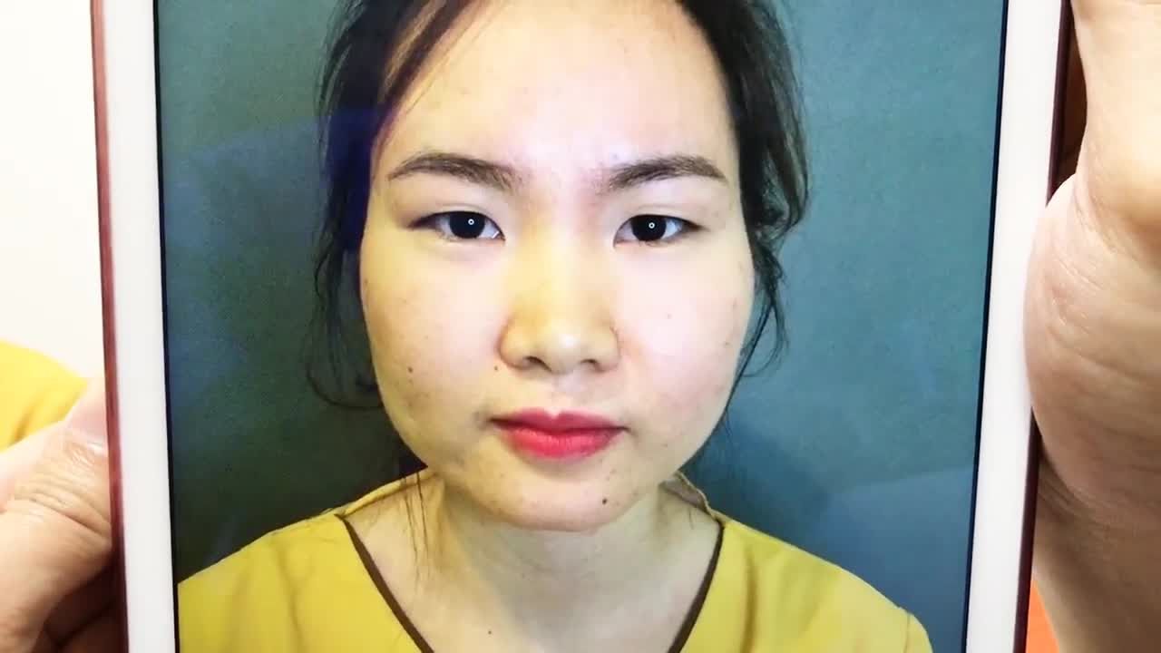 Lột Xác Chỉ Nhờ Cắt Mí, Bạn Có Tin??? Cùng Theo Dõi Nhé!