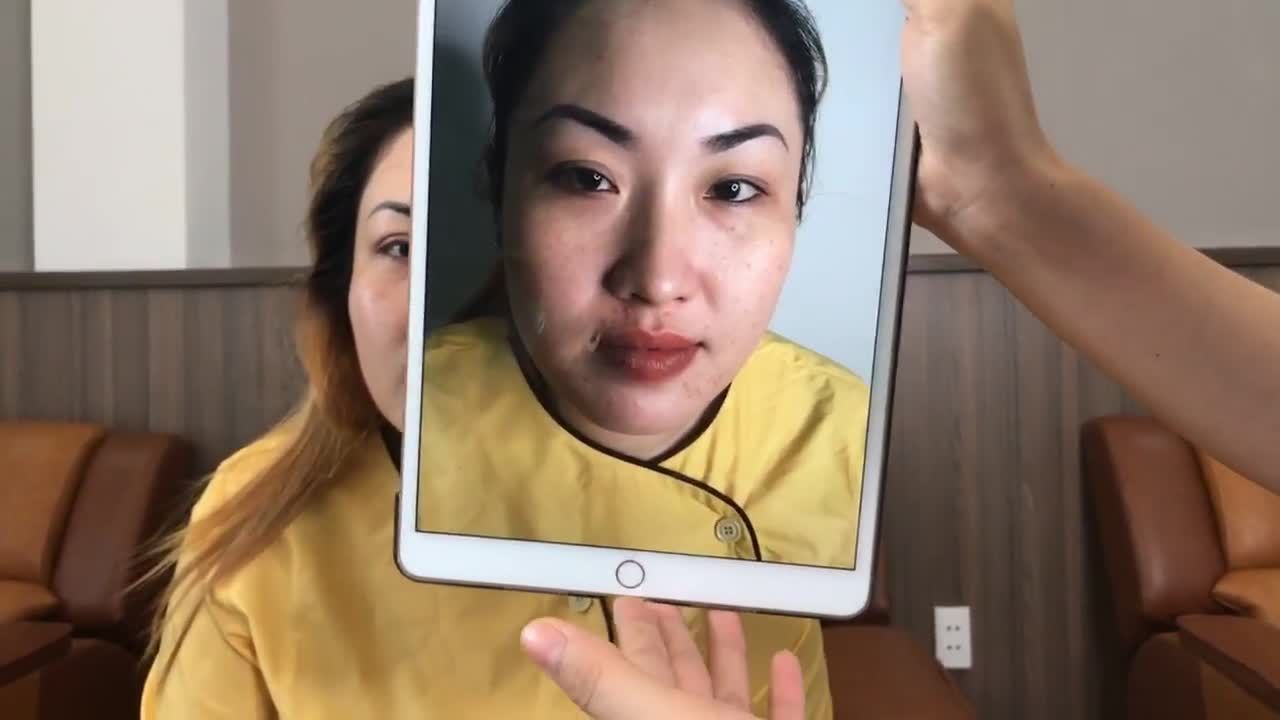 Mắt Đẹp Mí Xinh Là Kết Quả Khi Cắt Mí Mani Mini Deep 5D
