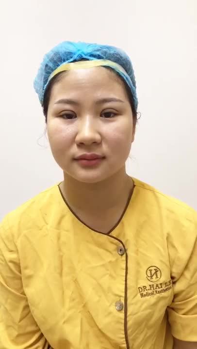 Mắt Đẹp Tuyệt Vời Sau Cắt Mí Mani Mini Deep 5D - Ca 251