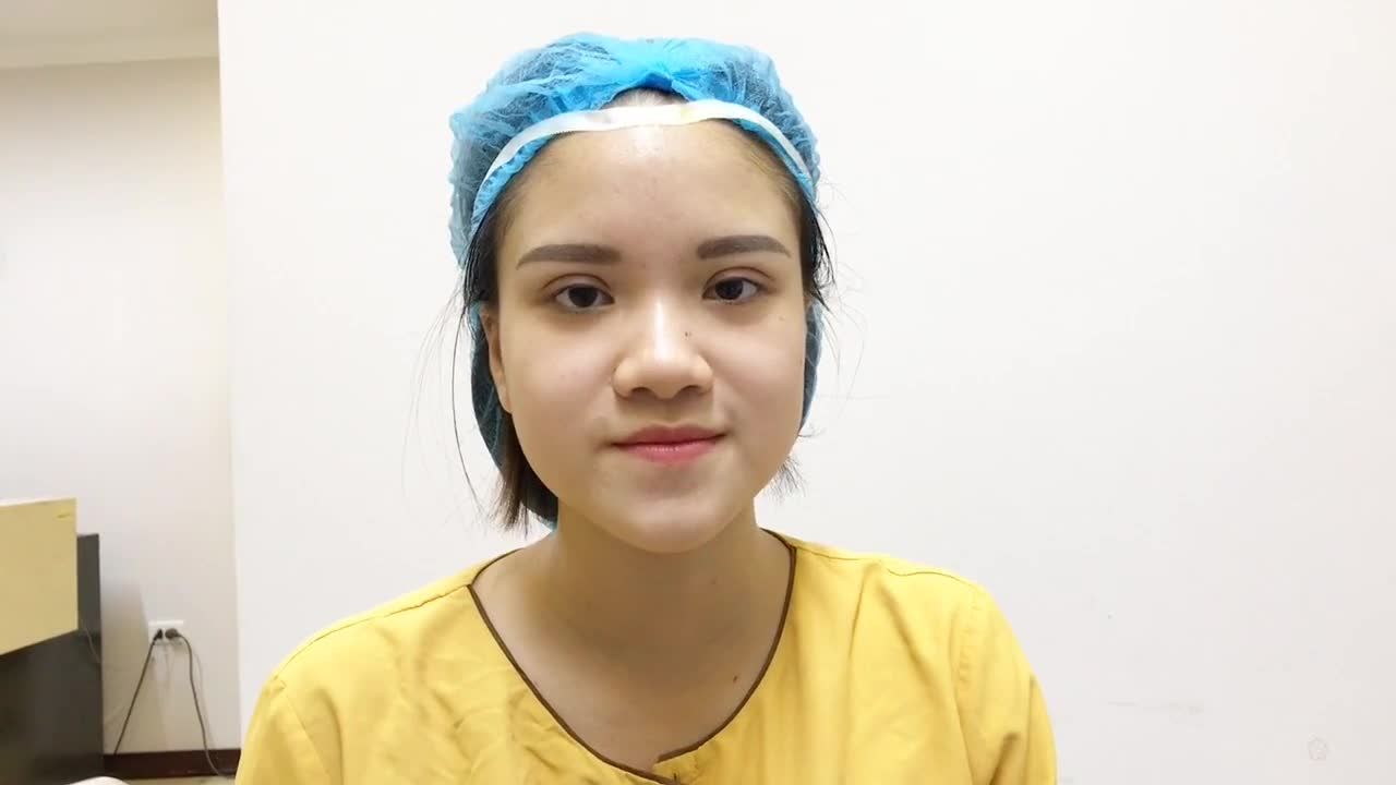 Mí Đẹp Chuẩn 100% Sau Khi Cắt Mí Double Deep 5D - Ca 227