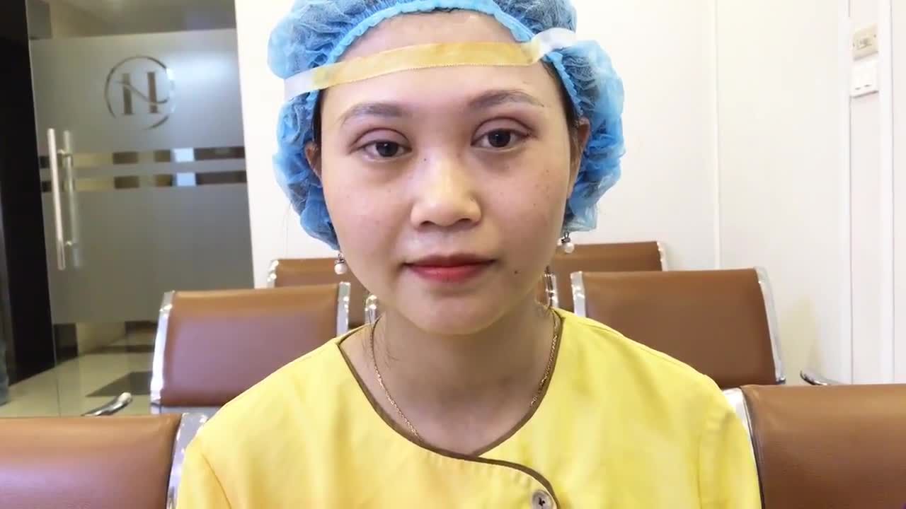 Mí Mắt To Tròn Đẹp Tự Nhiên Chỉ Sau 30 Phút Cắt Mí Mắt Tại Dr Hải Lê - Ca 133