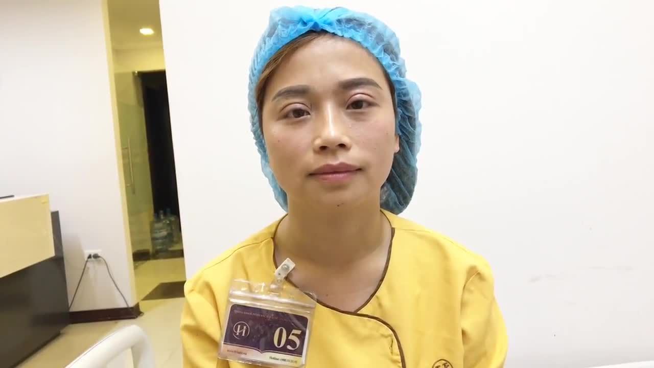 Mí Mắt Vừa Cắt Mí Mắt Xong Tại Dr Hải Lê - Ca 128