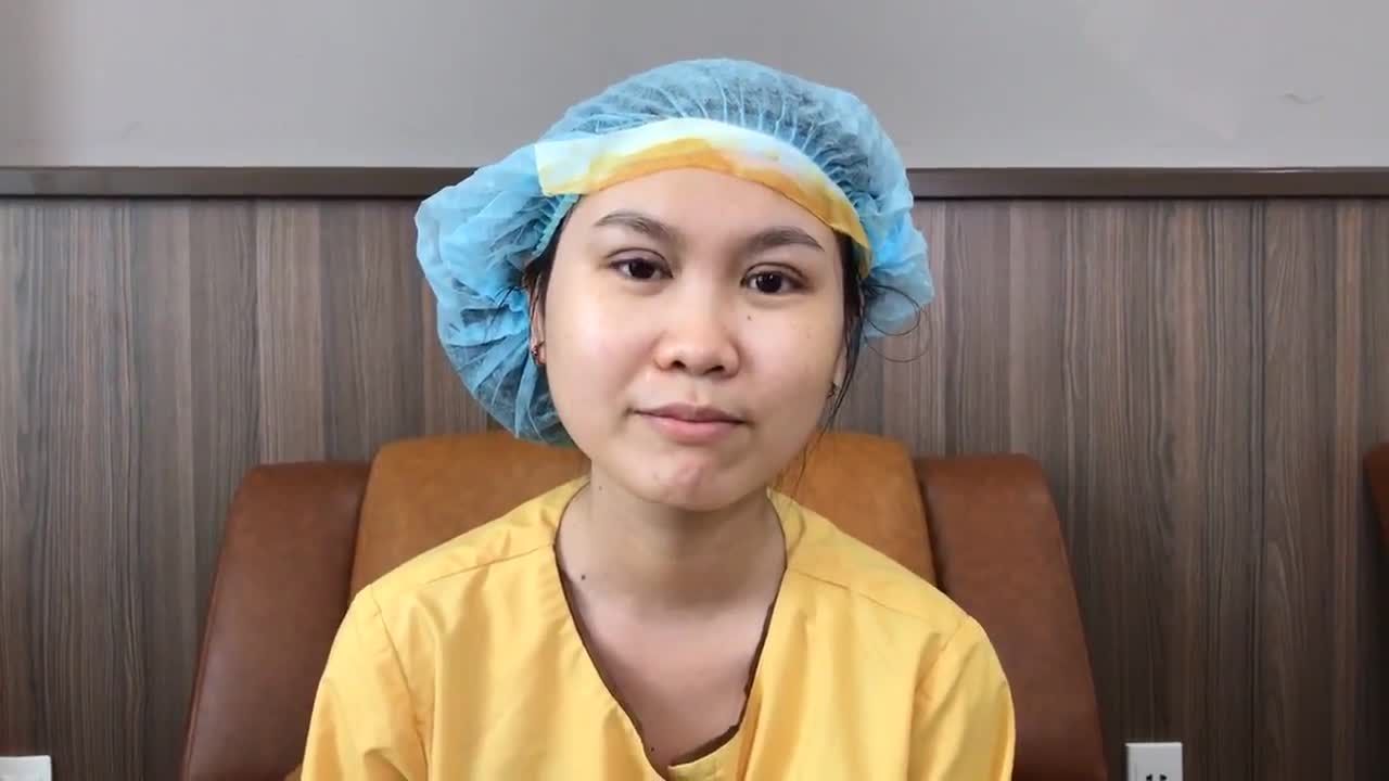 Nếp Mí Hoàn Hảo Ngay Sau Khi Cắt Mí Mani Mini Deep 5D - Ca 186