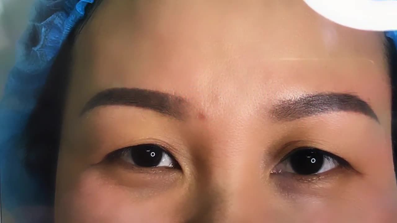 Tạo Mắt 2 Mí Nhẹ Nhàng Trong 30 Phút Bằng Cắt Mí Mani Open Deep 5D - Ca 192