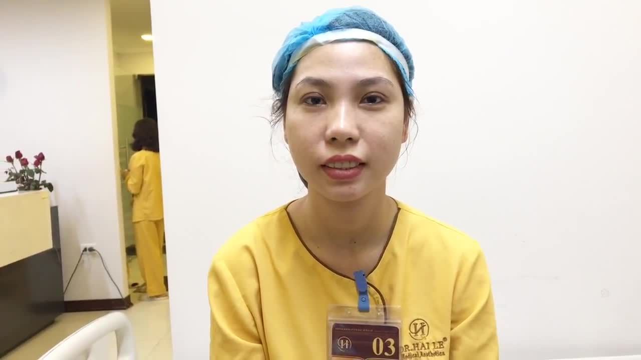 Tham Khảo Nếp Mí Vừa Thực Hiện Tại Dr Hải Lê - Ca 111