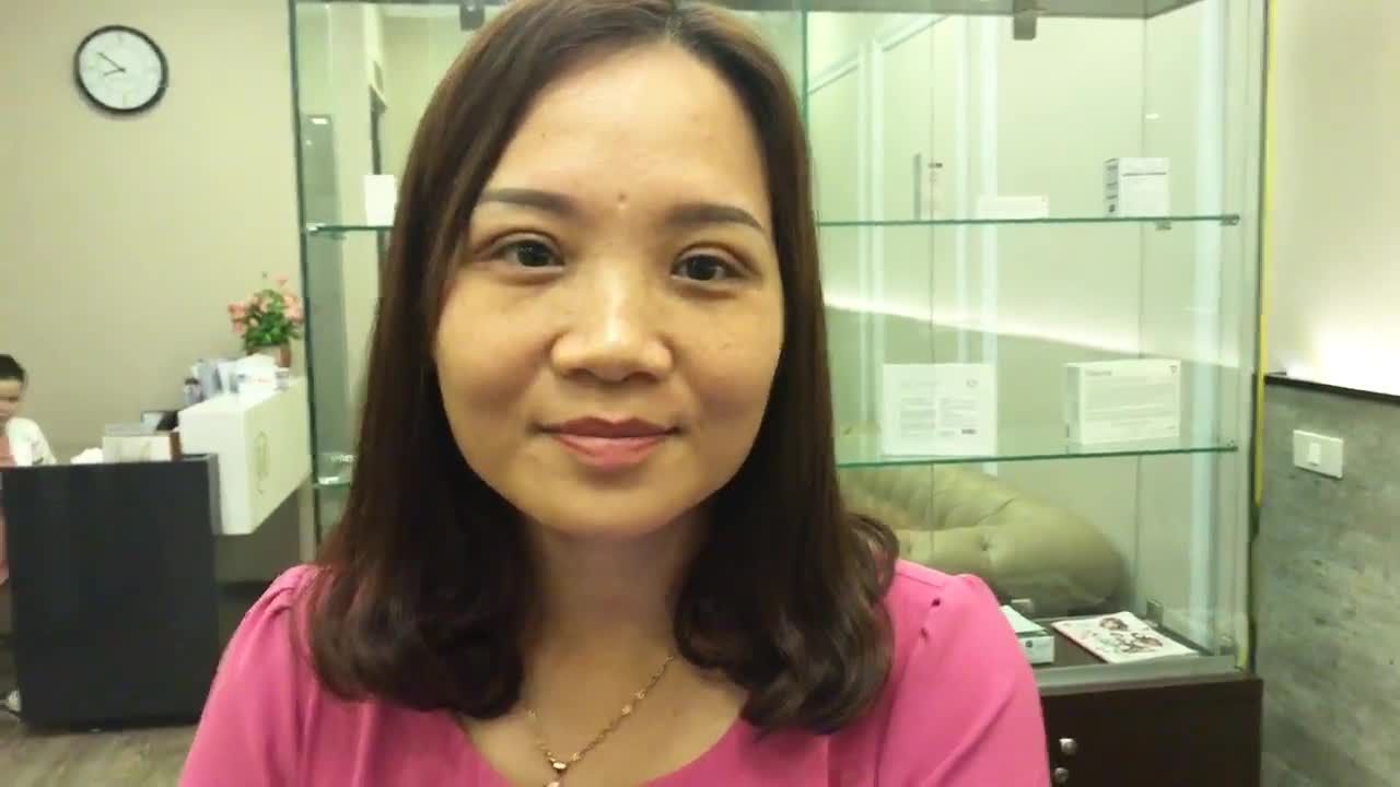 Vẻ Tươi Tắn Của Vị KH Sau Khi Sở Hữu Nếp Mí Mới Khi Cắt Mí Tại Dr Hải Lê