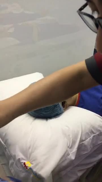 Nâng mũi cấu trúc 4D - Thẩm mỹ Kangnam - Ca 49