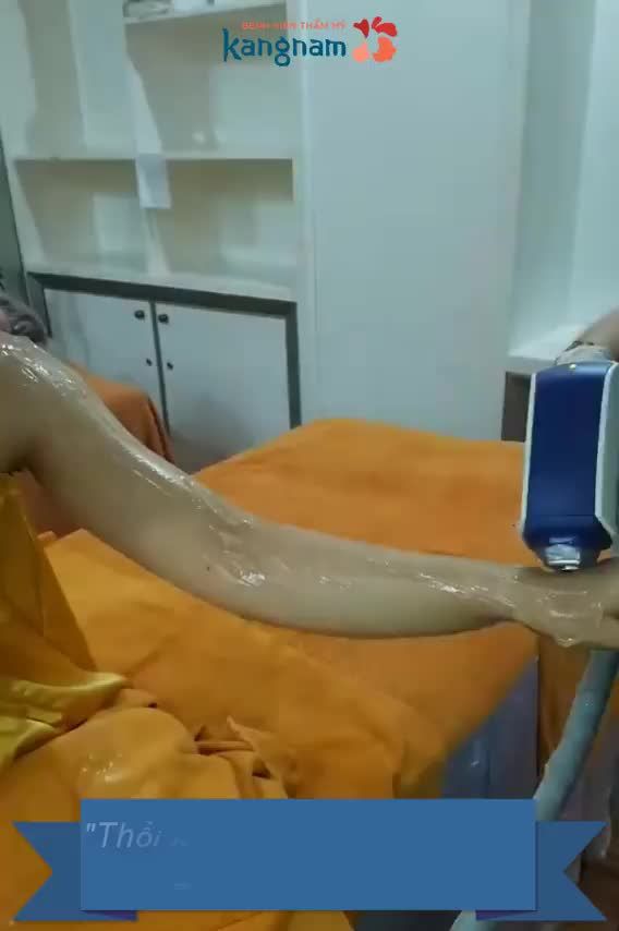 Triệt lông vĩnh viễn Diode Laser - Thẩm mỹ Kangnam - Ca 01