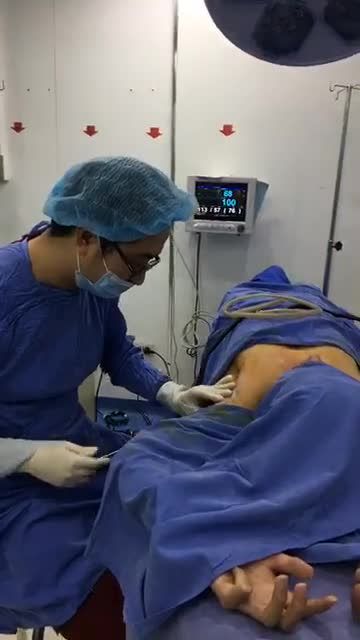 Hút tuyến mồ hôi nách - Thẩm mỹ Kangnam - Ca 03