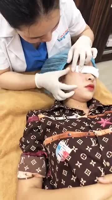 Trị tàn nhang - Thẩm mỹ Kangnam - Ca 07