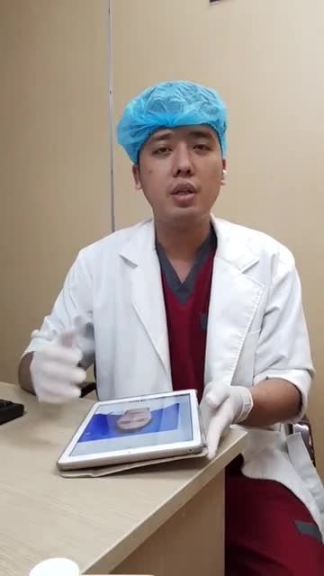 Nâng mũi cấu trúc 4D - Thẩm mỹ Kangnam - Ca 58