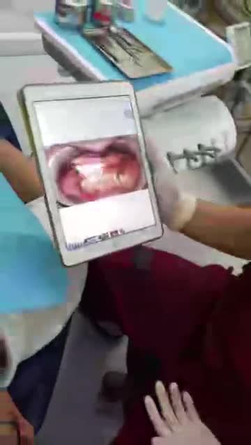 Trồng răng Implant - Thẩm mỹ Kangnam - Ca 01