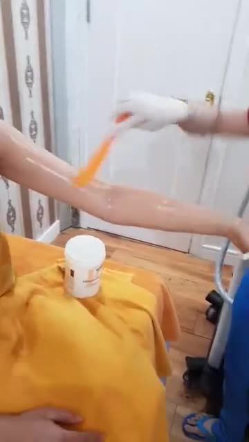 Triệt lông cánh tay - Thẩm mỹ Kangnam - Ca 03