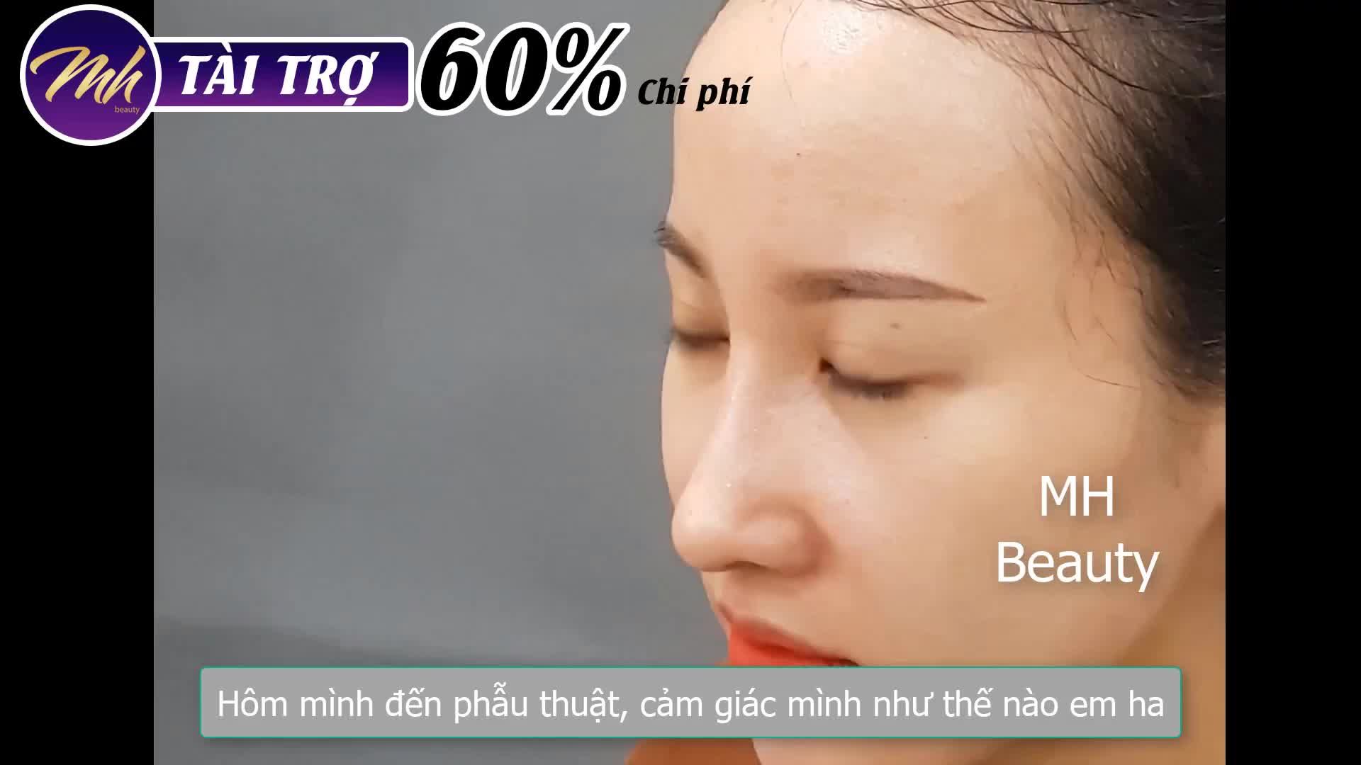 Nâng mũi - Bác sĩ Mã Hiệp - Ca 28