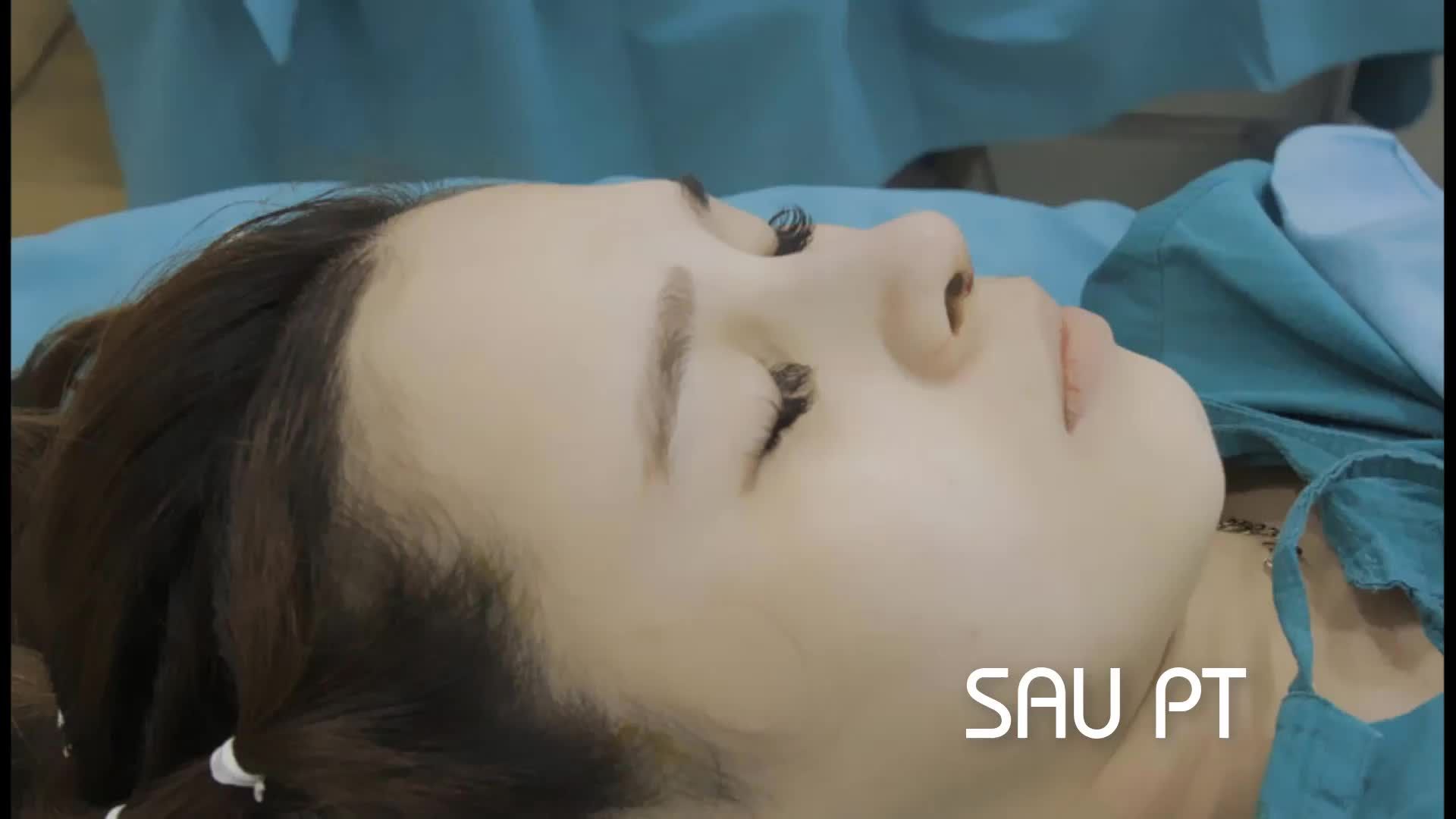 Nâng mũi - Bác sĩ Mã Hiệp - Ca 22