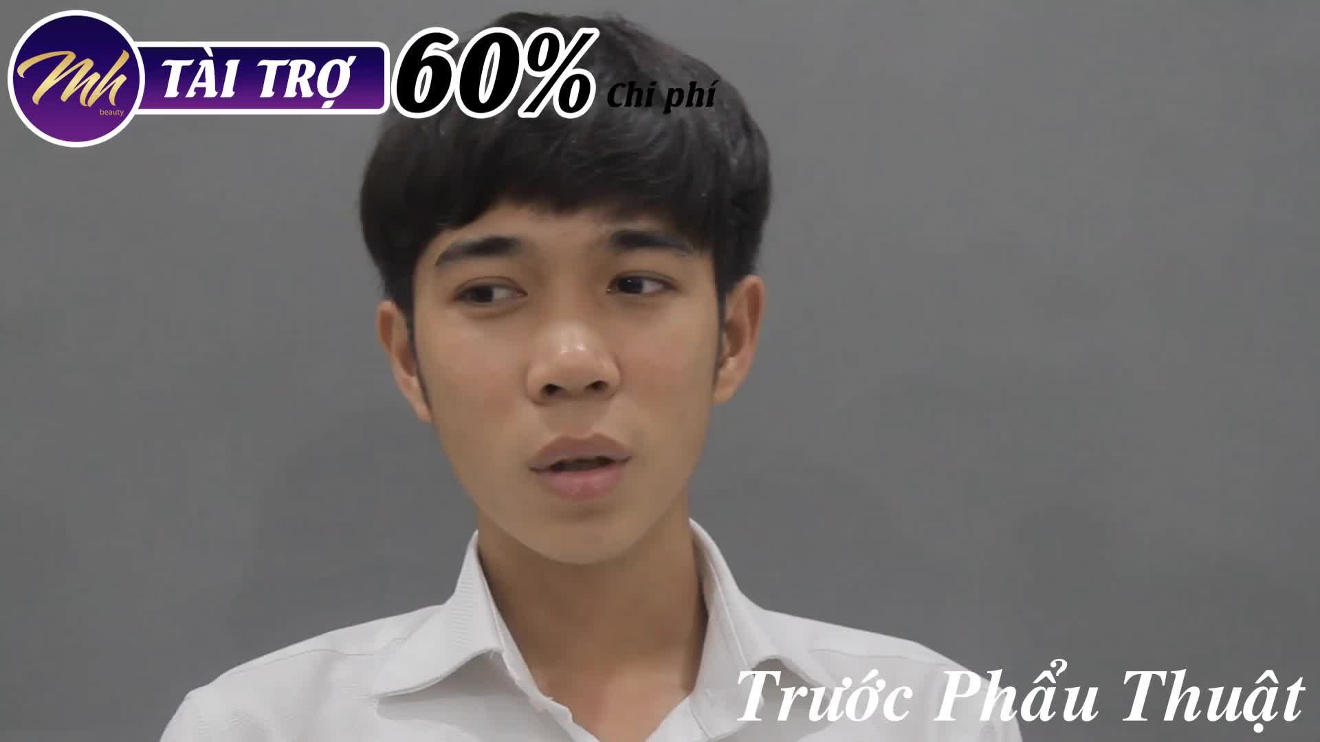 Nâng mũi - Bác sĩ Mã Hiệp - Ca 29