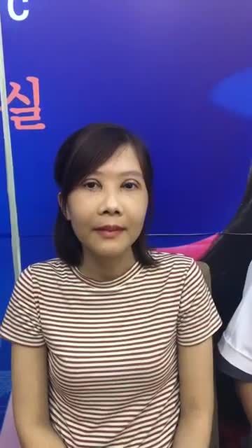 Chỉnh hàm trượt cằm - Thẩm mỹ Kangnam - Ca 01