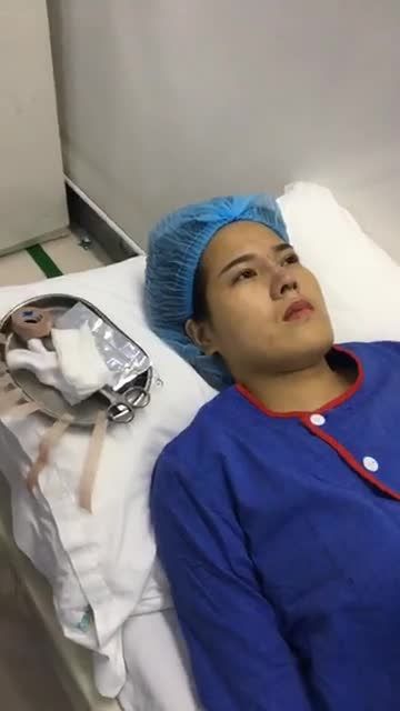 Nâng mũi cấu trúc 4D - Thẩm mỹ Kangnam - Ca 37