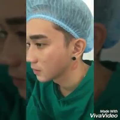 Nâng mũi - Bác sĩ Mã Hiệp - Ca 72