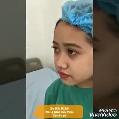 Nâng mũi - Bác sĩ Mã Hiệp - Ca 68
