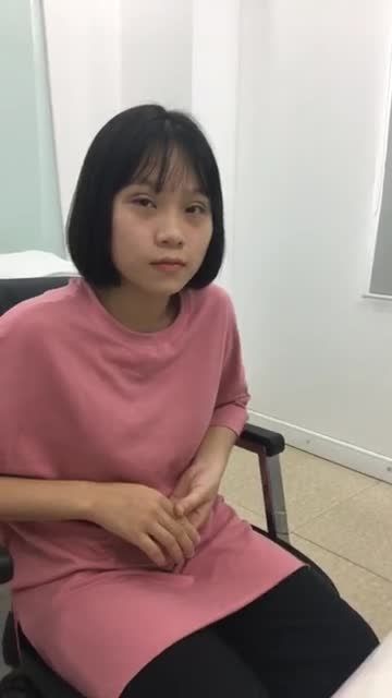 Bấm mí và mở góc mắt trong, ngoài - Thẩm mỹ Kangnam - Ca 13