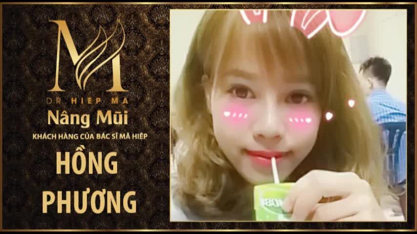 Nâng mũi - Bác sĩ Mã Hiệp - Ca 60