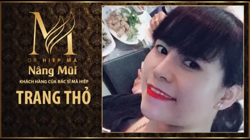 Nâng mũi - Bác sĩ Mã Hiệp - Ca 50