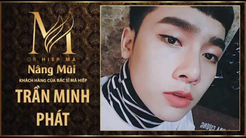 Nâng mũi - Bác sĩ Mã Hiệp - Ca 51